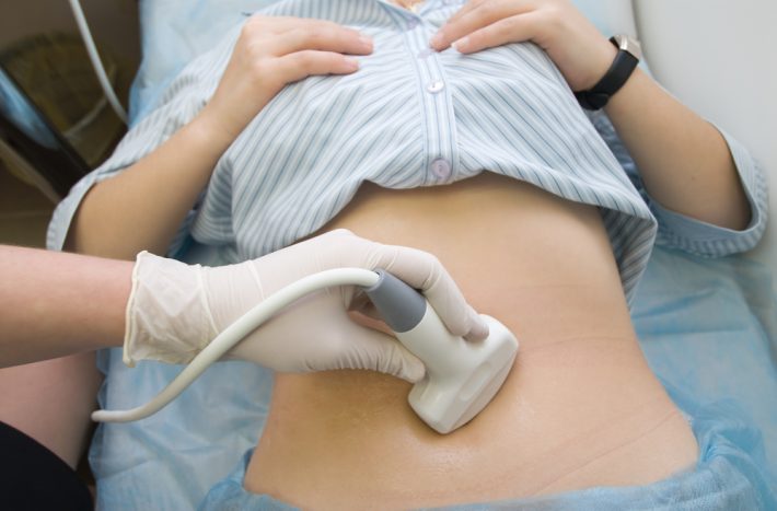ultrazvuk břicha