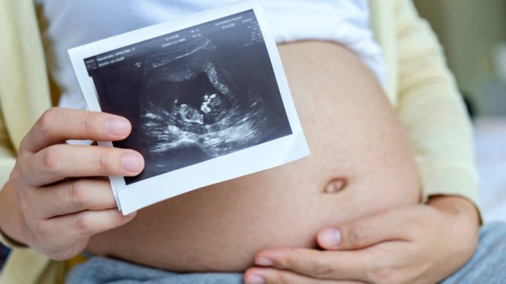 těhotná a ultrazuvk