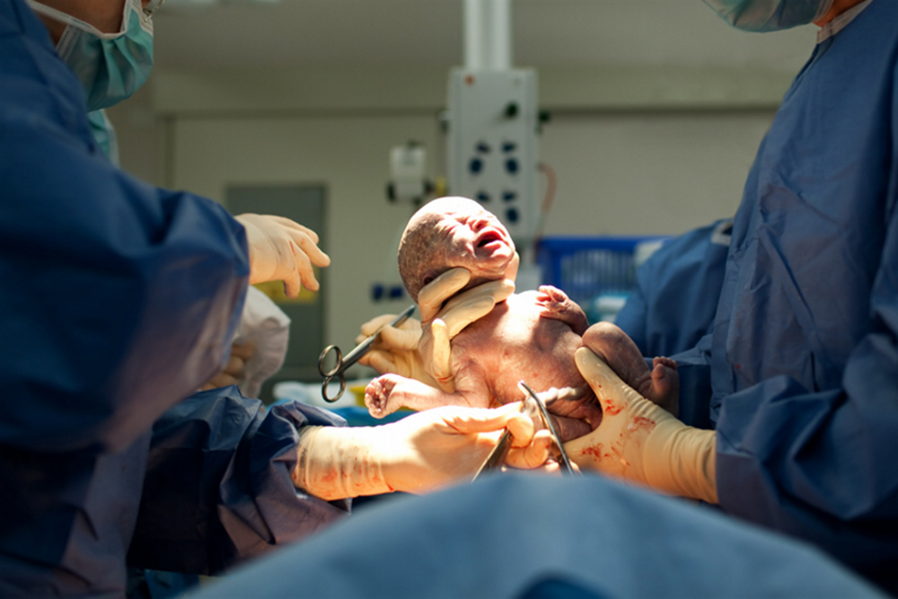 Porodní sál s lékaři a novorzencem