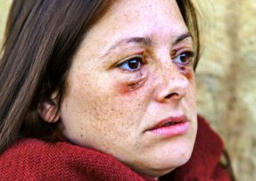 Domácí násilí zbitá žena
