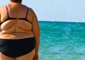 Obézní žena v plavkách