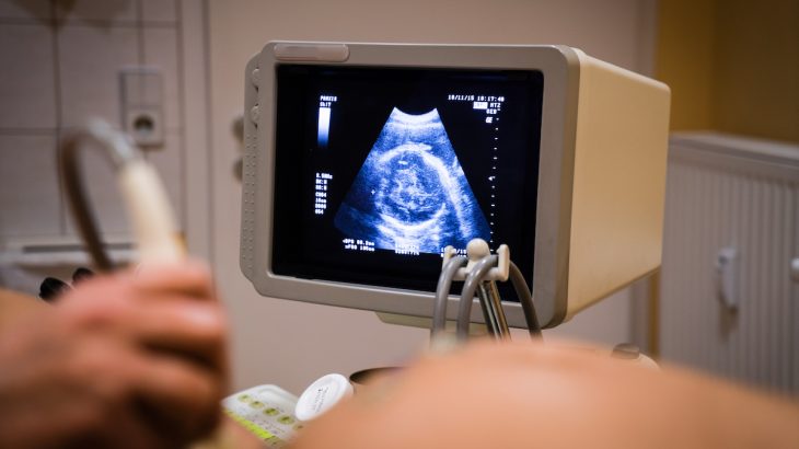ultrazvuk maminka