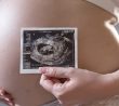 Břicho těhotné ženy a snímek z ultrazvuku