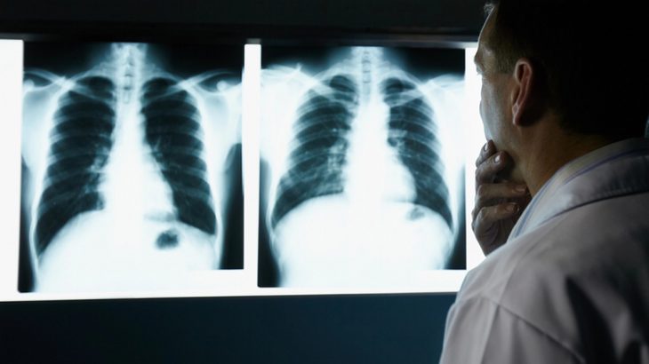 Lékař zkoumá rentgen plic