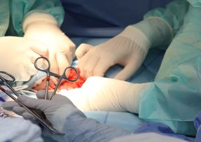 Probíhající operace